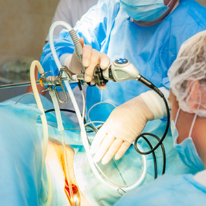 Best Laparoscopic Surgeon